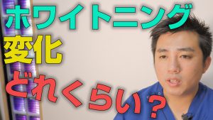 ホワイトニングでどれくらい変化するのか？【大阪市都島区の歯医者 アスヒカル歯科】